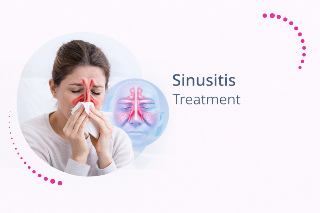 Sinusitis Treatment